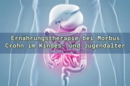 Ernährungstherapie bei Morbus Crohn im Kindes- und Jugendalter Overlay Image