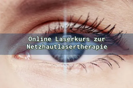 Online Laserkurs zur Netzhautlasertherapie Overlay Image