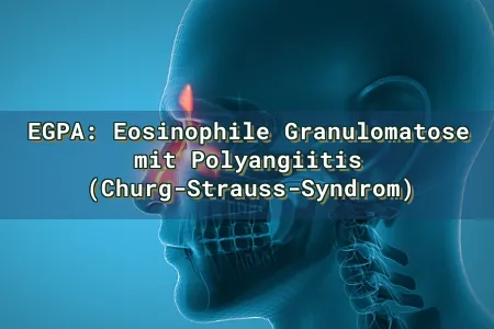EGPA: Eosinophile Granulomatose mit Polyangiitis (Churg-Strauss-Syndrom) Overlay Image