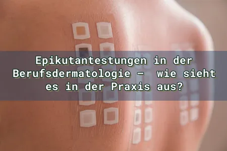 Epikutantestungen in der Berufsdermatologie –  wie sieht es in der Praxis aus? Overlay Image