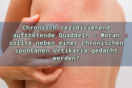 Chronisch rezidivierend auftretende Quaddeln – Woran sollte neben einer chronischen spontanen Urtikaria gedacht werden? Overlay Image