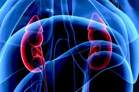Cushing-Syndrom: Akute Komplikationen und Folgen des Hypercortisolismus – Teil 1