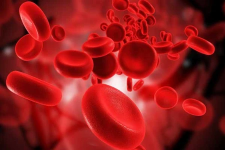 Spezielles präoperatives Patient Blood Management bei Lebererkrankungen