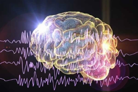 Epilepsy Forward