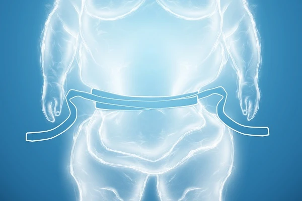 (Haus-)ärztliche Versorgung bei Adipositas: Umsetzung zwischen Anspruch und Wirklichkeit