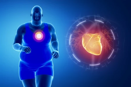 Herz und Hirn im Risiko – KHK, Schlaganfall und HFpEF bei Adipositas