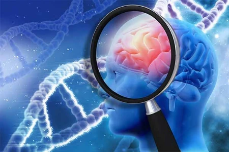 Workshop Epilepsie und Parkinson – Über Kognition und Fluktuationen