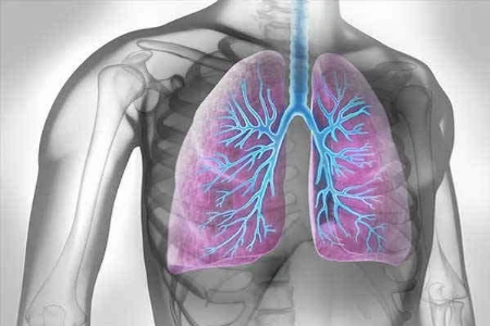 Antifibrotische Therapie bei progredienter exogen-allergischer Alveolitis: Starten wir zu spät?