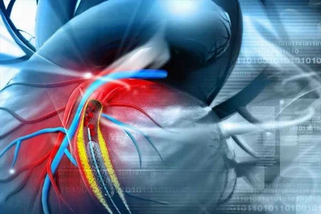 Pulmonale Hypertonie aus pneumologischer und kardiologischer Sicht