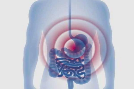 Kuhmilchallergie mit Manifestation im Gastrointestinaltrakt