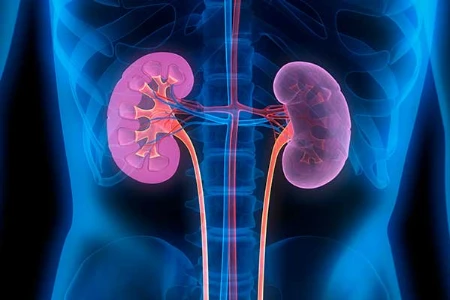 Relevanz klinischer Endpunkte bei CKD (Chronic Kidney Disease)